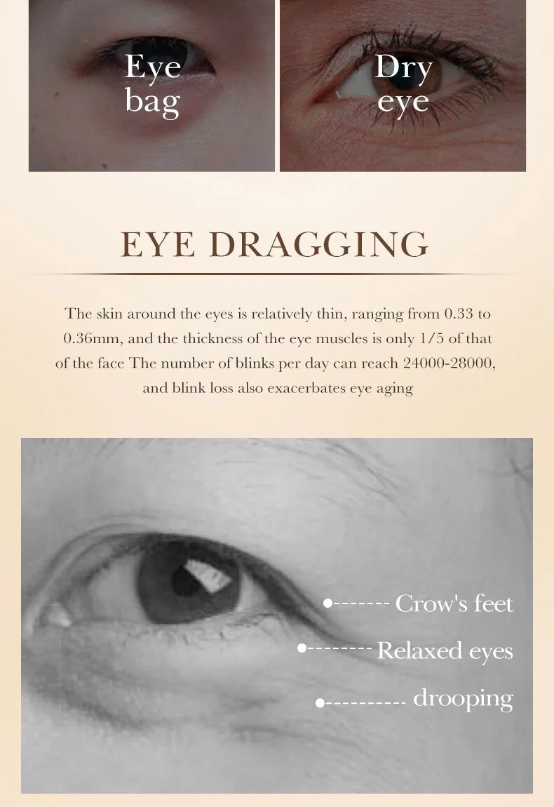 Eye Cream Anti Dark circles||anti wrinkles